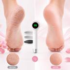 Rechargeable Electric Foot Callus Remover